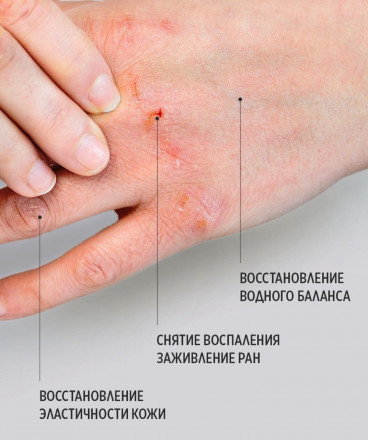 SMART   Бальзам для быстрого восстановления кожи  HEALING BALM   150мл оптом