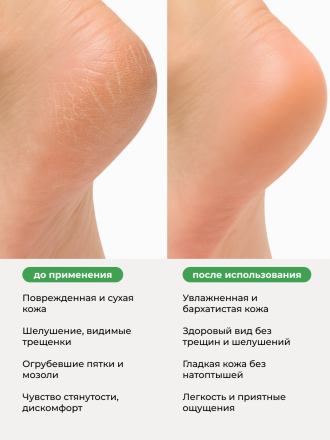 MANITA   Крем для ног   С МЕНТОЛОМ И КАМФОРОЙ   500мл   {7726} оптом