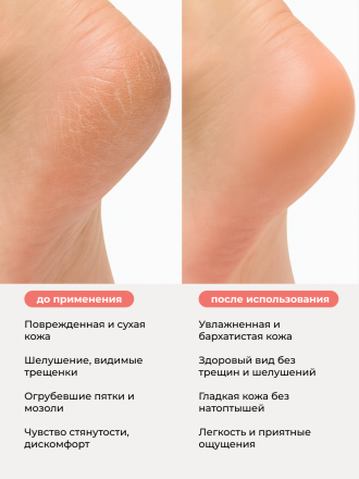 MANITA   Крем для ног   С МОЧЕВИНОЙ 12%   500мл   {7724} оптом