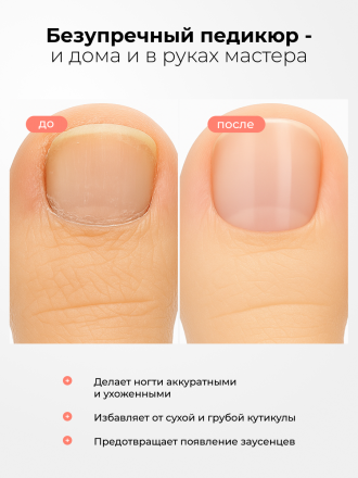 MANITA   Нано Лезвие С МОЧЕВИНОЙ 25%  100мл   Кератогель для педикюра   {7730} оптом