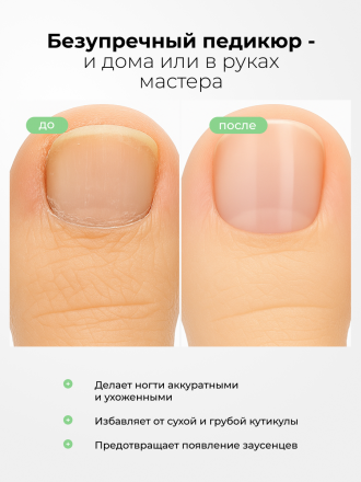 MANITA   Нано Лезвие ЩЕЛОЧНОЙ  100мл   Кератогель для педикюра   {7728} оптом